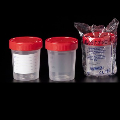 Bote plástico PP tapón rosca 150 ml D-409702. Caja 450 unidades