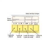 Targetes determinació grup sanguini ME-91249. Capsa 100 unitats