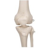 Model osteològic 1020171. Esquelet humà Stan A10 1:1 amb rodes