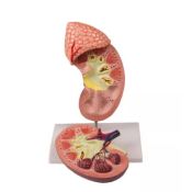 Anatomical model 1014211. Human kidney with adrenal gland 1: 1 in 2 pieces