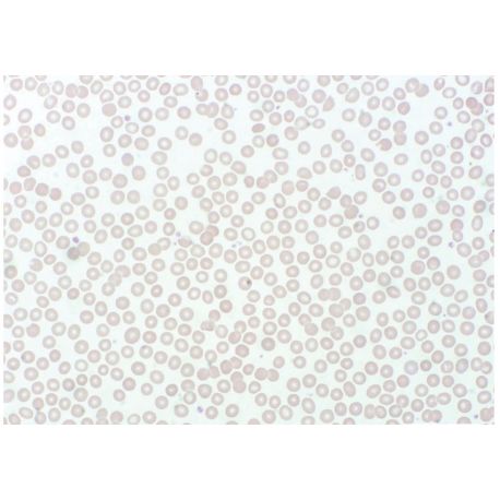 Preparació microscòpica Jeulin LN-575406. Sang humana