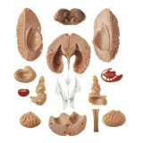 Modelo anatómico Somso BS-25. Cerebro humano 1:1 en 15 partes