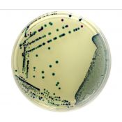 Agar cromogénico E.Coli coliformes preparado L-11613. Caja 20
