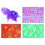 Preparacions microscòpiques Lieder biologia A. Capsa 25 peces