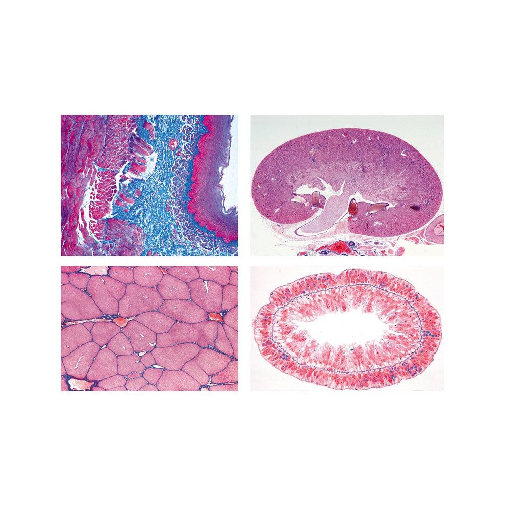 Preparacions microscòpiques L-4430 (15p). Metabolisme