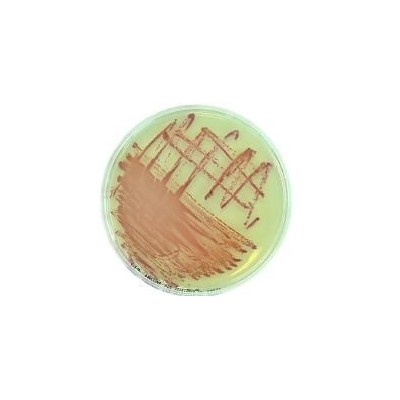 Chromatic MRSA supplement L-81078. 10 vials