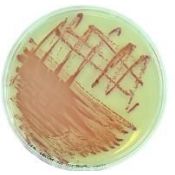 Chromatic MRSA supplement L-81078. 10 vials