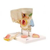 Nas amb cavidatats paranasals, dividida en 5 parts