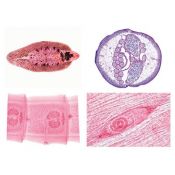 Preparaciones microscópicas L-3900 (50p). Parasitismo completo