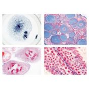 Preparacions microscòpiques L-4480 (19p). Genètica-Reproducció