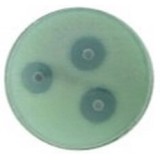 Identifiación microbiana